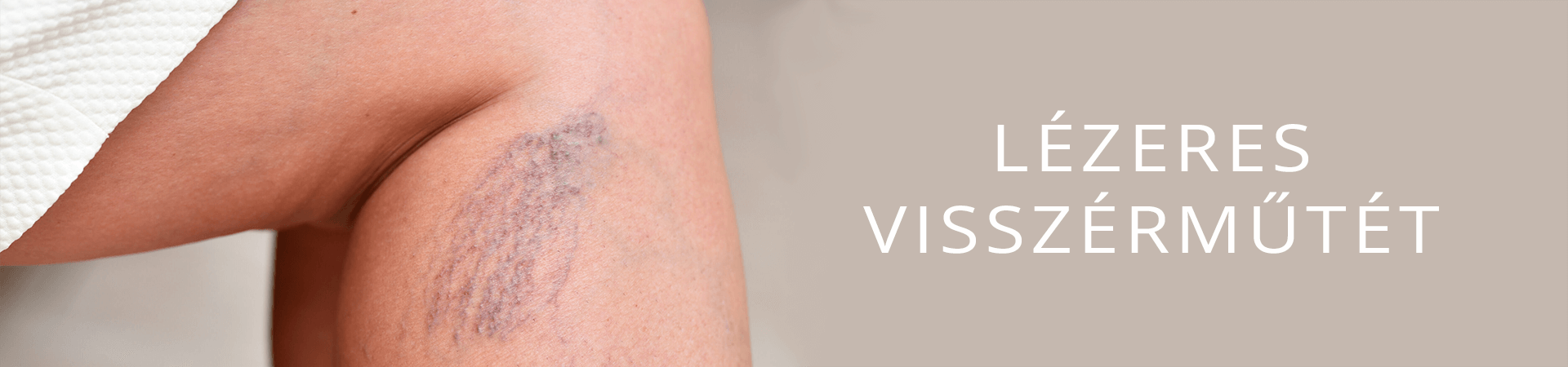 Lézeres visszérműtét